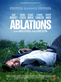 Ablations streaming
